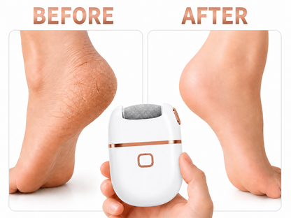 Foot Pedi Pro